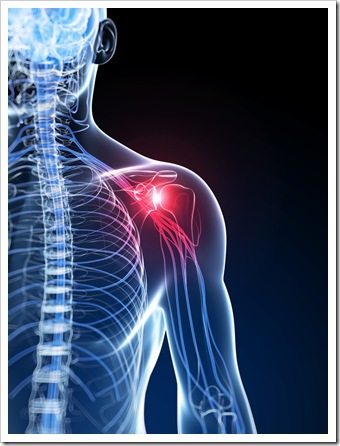 Shoulder Pain Caldwell NJ Rotator Cuff Syndrome