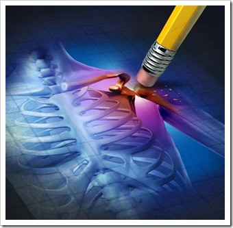 Scar Tissue Caldwell NJ Chiropractic
