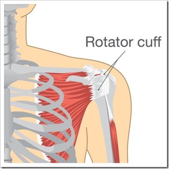 Shoulder Pain Caldwell NJ Rotator Cuff Injury